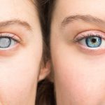 Eye Conditions and Optometry